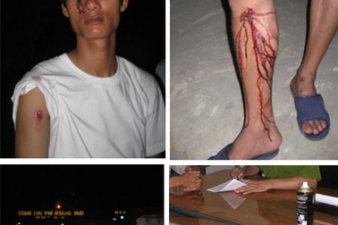 Nhân viên trạm thu phí và tài xế ẩu đả vì... chiếc vé