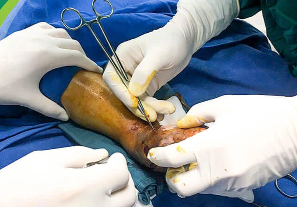 Liên tiếp trẻ bị rắn cắn nguy kịch, bác sĩ hướng dẫn sơ cứu nhanh nhất - 2 Liên tiếp trẻ bị rắn cắn nguy kịch, bác sĩ hướng dẫn sơ cứu nhanh nhất - 2