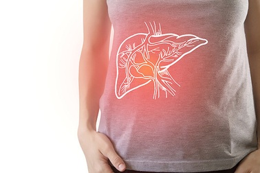 Gan nhiễm mỡ, tránh ăn gì?