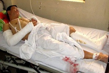 Cơ thủ Lê Dũng bị chém trọng thương 