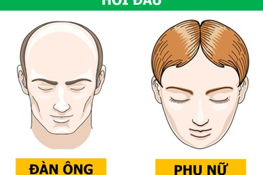 “Kỳ lạ” những vấn đề sức khỏe ảnh hưởng đàn ông và phụ nữ theo cách khác biệt
