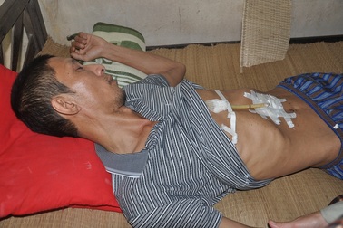 Bố ung thư giai đoạn cuối bất lực nhìn con phải nghỉ học giữa chừng