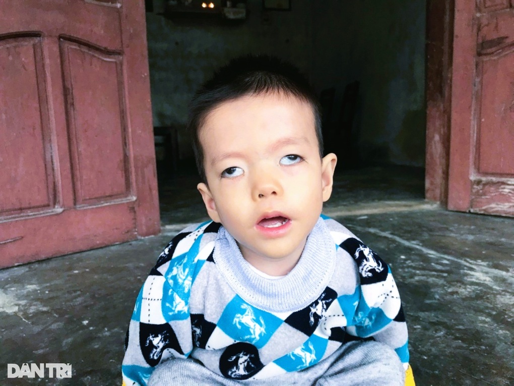Hai con mắc cùng lúc nhiều bệnh, người mẹ cầu cứu - 1 Hai con mắc cùng lúc nhiều bệnh, người mẹ cầu cứu - 1