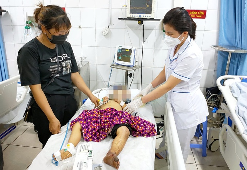 Đang ngủ trên giường, bé trai 2 tuổi bị rắn hổ mang cắn nguy kịch - 2 Đang ngủ trên giường, bé trai 2 tuổi bị rắn hổ mang cắn nguy kịch - 2