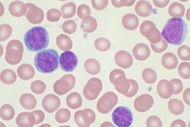 Phát hiện ra mục tiêu đồng hồ sinh học ở tế bào làm chậm ung thư