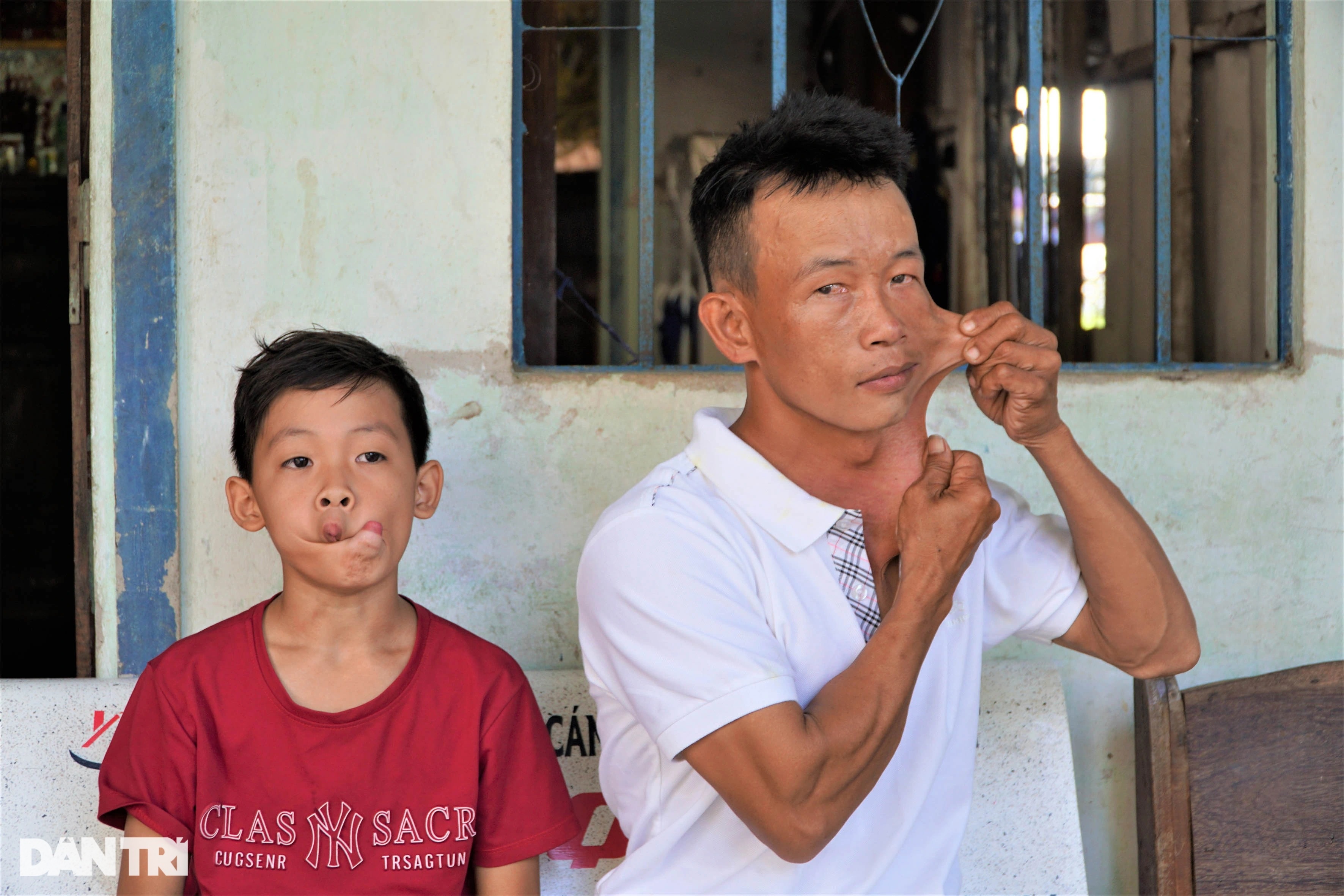 Người đàn ông miền Tây có làn da kéo giãn như cao su tay chân bẻ gập 180 độ