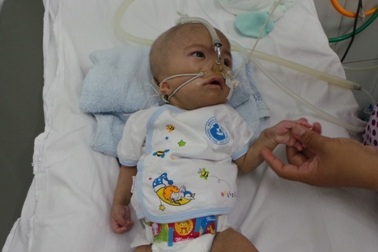 Nhói lòng, bé 9 tháng tuổi chỉ có da bọc xương