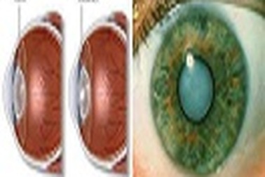 Nguyên nhân và giải pháp