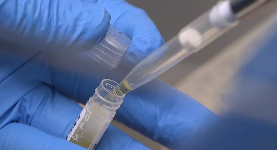 Phát hiện loại enzyme ảnh hưởng đến sự lây lan của SARS-CoV-2 - 1 Phát hiện loại enzyme ảnh hưởng đến sự lây lan của SARS-CoV-2 - 1