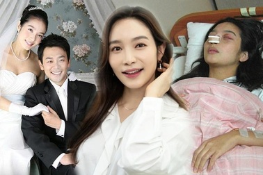 Cuộc hồi sinh ngoạn mục của nữ diễn viên bị chồng đánh gãy mũi, sảy thai