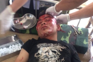 Triệu tập 4 đối tượng liên quan đến vụ côn đồ bảo kê máy gặt