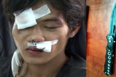 Khởi tố kẻ cướp đâm chết nạn nhân, trọng thương công an