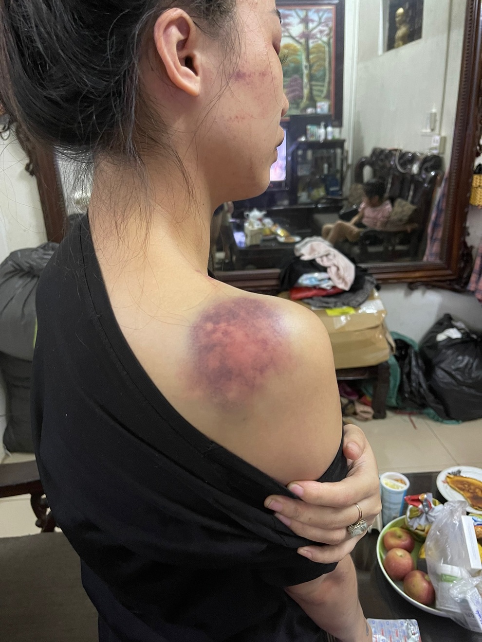 Người chồng bị tố tra tấn vợ thừa sống thiếu chết nêu phản bác gây choáng - 2 Người chồng bị tố tra tấn vợ thừa sống thiếu chết nêu phản bác gây choáng - 2