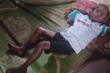 Cháu bé 8 tuổi bị tẩm xăng đốt vì… không chịu đi ăn trộm