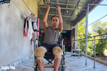 Nghiệt ngã số phận chàng kỹ sư tập bò, học nói sau tai nạn oan nghiệt