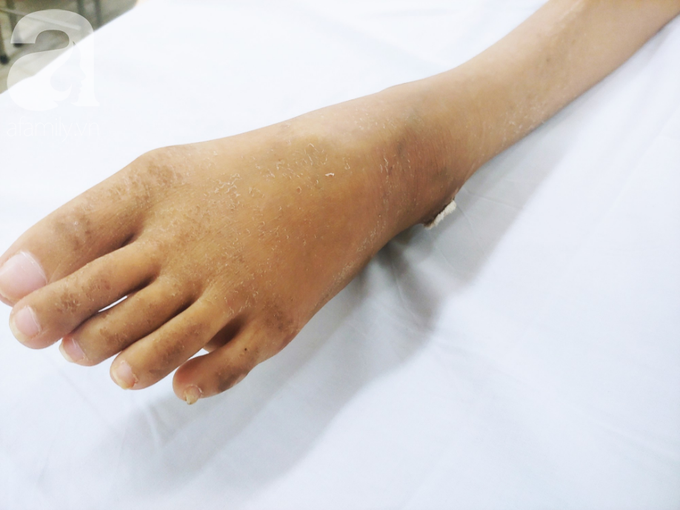 Người mẹ bật khóc nhìn con gái bị cắt chân, nằm liệt giường sau khi mổ não - Ảnh 7. Người mẹ bật khóc nhìn con gái bị cắt chân, nằm liệt giường sau khi mổ não - Ảnh 7.