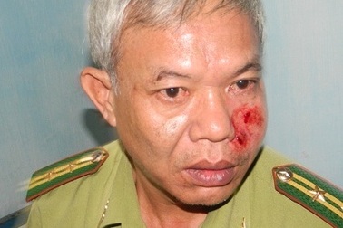 Chém cán bộ kiểm lâm, chủ buôn gỗ lĩnh án