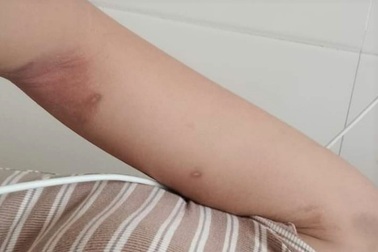 Người vợ trẻ tử vong nghi do bị chồng bạo hành