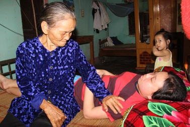 Xót xa nữ sinh 18 tuổi mồ côi bố mẹ nguy kịch vì bệnh lupus ban đỏ