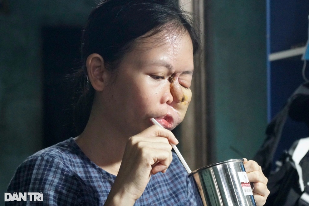Cô gái đau khổ bởi hễ ra đường là trẻ con vừa thấy đã khóc thét, bỏ chạy - 6 Cô gái đau khổ bởi hễ ra đường là trẻ con vừa thấy đã khóc thét, bỏ chạy - 6