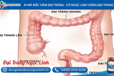 Viêm đại tràng sigma là gì, nguy hiểm không và chữa như thế nào?