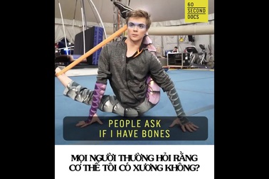 Gặp gỡ “người không xương” độc nhất của thế giới