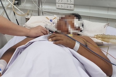 TPHCM: Cô gái 19 tuổi đông đặc cả 2 bên phổi, nguy kịch vì sốt xuất huyết