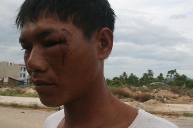 Nhiều công nhân bị đánh trong đêm