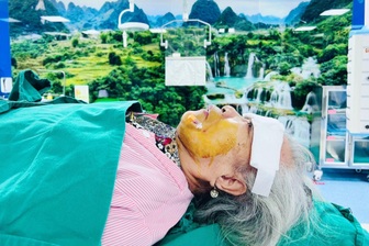 Tiêm cồn diệt hạch Gasser - Thoát đau dây thần kinh số 5 đeo bám suốt 1 năm