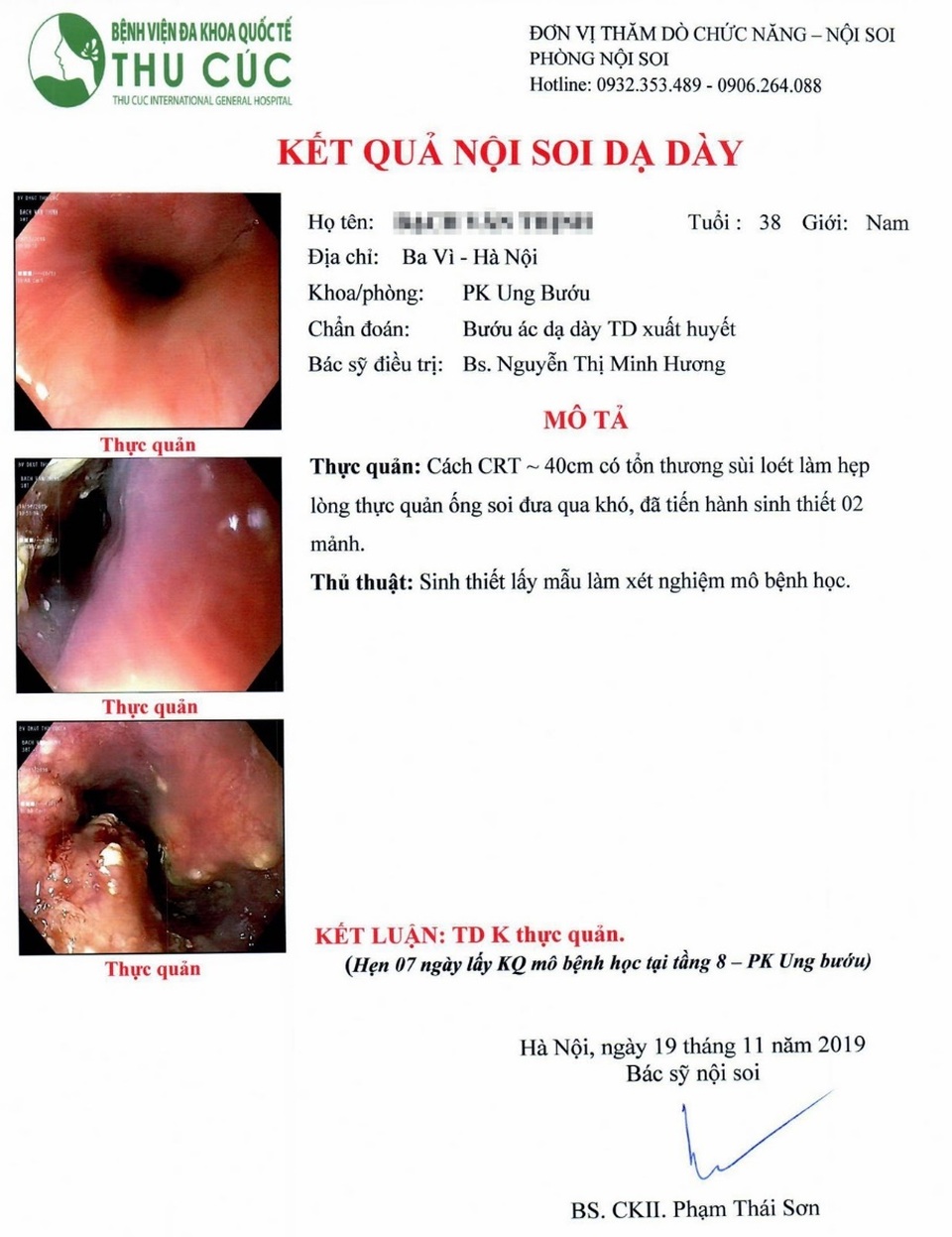 38 tuổi phát hiện ung thư thực quản dù không có triệu chứng gì - 1 38 tuổi phát hiện ung thư thực quản dù không có triệu chứng gì - 1