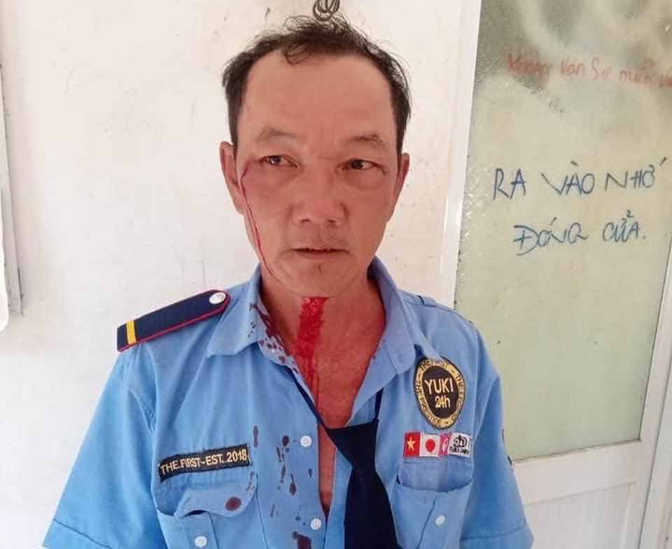 Khởi tố thanh niên đánh bảo vệ vì nhắc đeo khẩu trang - 2 Khởi tố thanh niên đánh bảo vệ vì nhắc đeo khẩu trang - 2