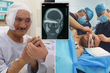 Lưỡi dao dài 10cm nằm trong đầu suốt 26 năm