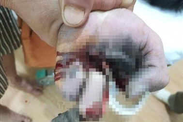 Cả đêm không ngủ vì tin "điện thoại phát nổ, học sinh lớp 5 tử vong"