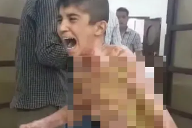 Những đứa trẻ Syria bị trúng bom trong chiến sự dữ dội của Thổ Nhĩ Kỳ