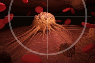 Cảnh giác với 7 triệu chứng của ung thư