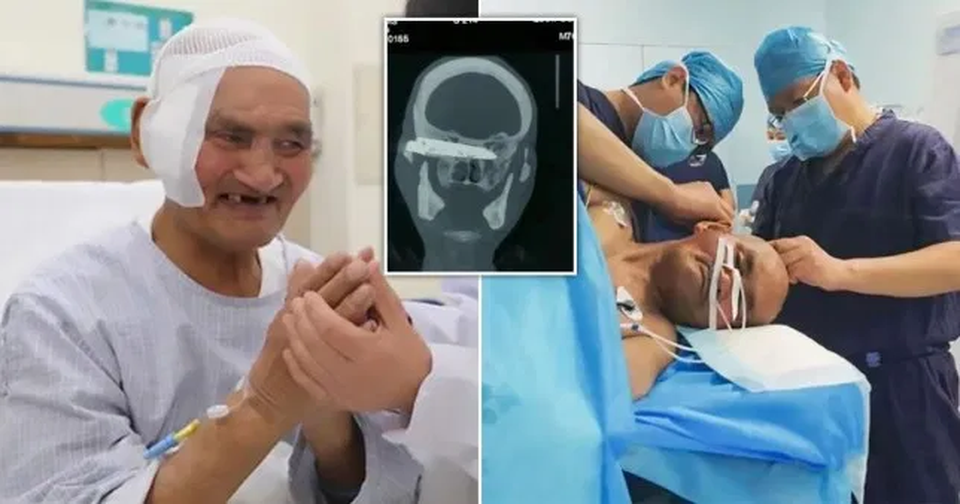 Lưỡi dao dài 10cm nằm trong đầu suốt 26 năm - 1 Lưỡi dao dài 10cm nằm trong đầu suốt 26 năm - 1