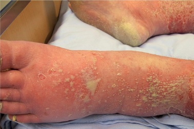 Một cơ sở y tế ở TPHCM mỗi năm tiếp nhận 52.000 lượt khám căn bệnh suốt đời