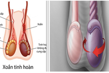 Chàng trai mất một bên tinh hoàn chỉ vì chủ quan