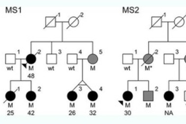 Đột biến gen có thể liên quan trực tiếp đến bệnh đa xơ cứng