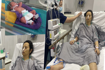 Tiếng kêu cứu khẩn cấp của thai phụ suy gan phải mổ bắt con