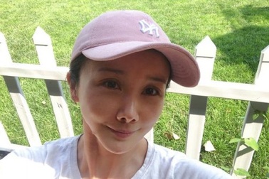 “Mỹ nhân tụt váy” Tôn Phi Phi khác lạ vì lạm dụng dao kéo thẩm mỹ