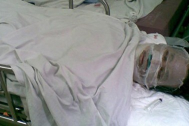 Tẩm xăng thiêu sống 2 con, bố cũng tử vong 