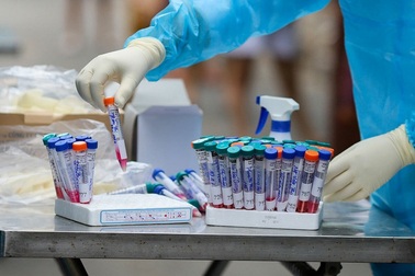 Ca Covid-19 thứ 75 tử vong là bệnh nhân cao tuổi ở TPHCM