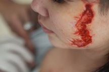 Bài 4: Diễn biến mới nhất vụ cô gái bị xăm “quái vật” lên mặt và ngực