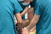 Bác sĩ buộc phải gây mê mổ mắt cho bệnh nhân vì lý do đặc biệt