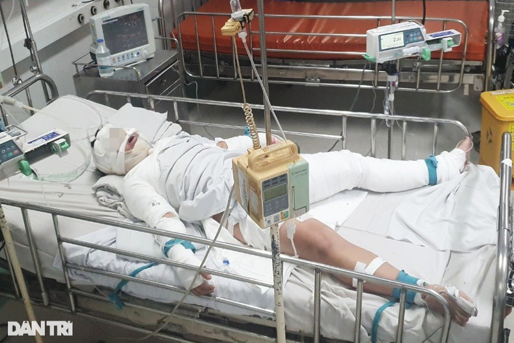 Người mẹ lóc toàn bộ da đùi ghép cho con trai 5 tuổi bỏng thương tâm - 4 Người mẹ lóc toàn bộ da đùi ghép cho con trai 5 tuổi bỏng thương tâm - 4