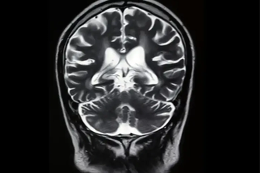 Nghiên cứu mới: Trẻ thiếu tập trung do xem điện thoại quá nhiều