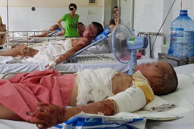 Vợ thành “đuốc sống” vì điếu thuốc lá của chồng