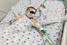 Sốt, tiểu ít, bé 6 tháng tuổi suy thận cấp vì sỏi tiết niệu hiếm gặp