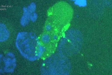 Cận cảnh cách virus HIV lây nhiễm khi quan hệ tình dục